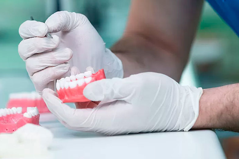 Rehabilitacion Oral